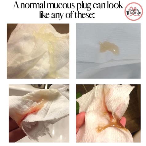 what does pregnancy mucus look like